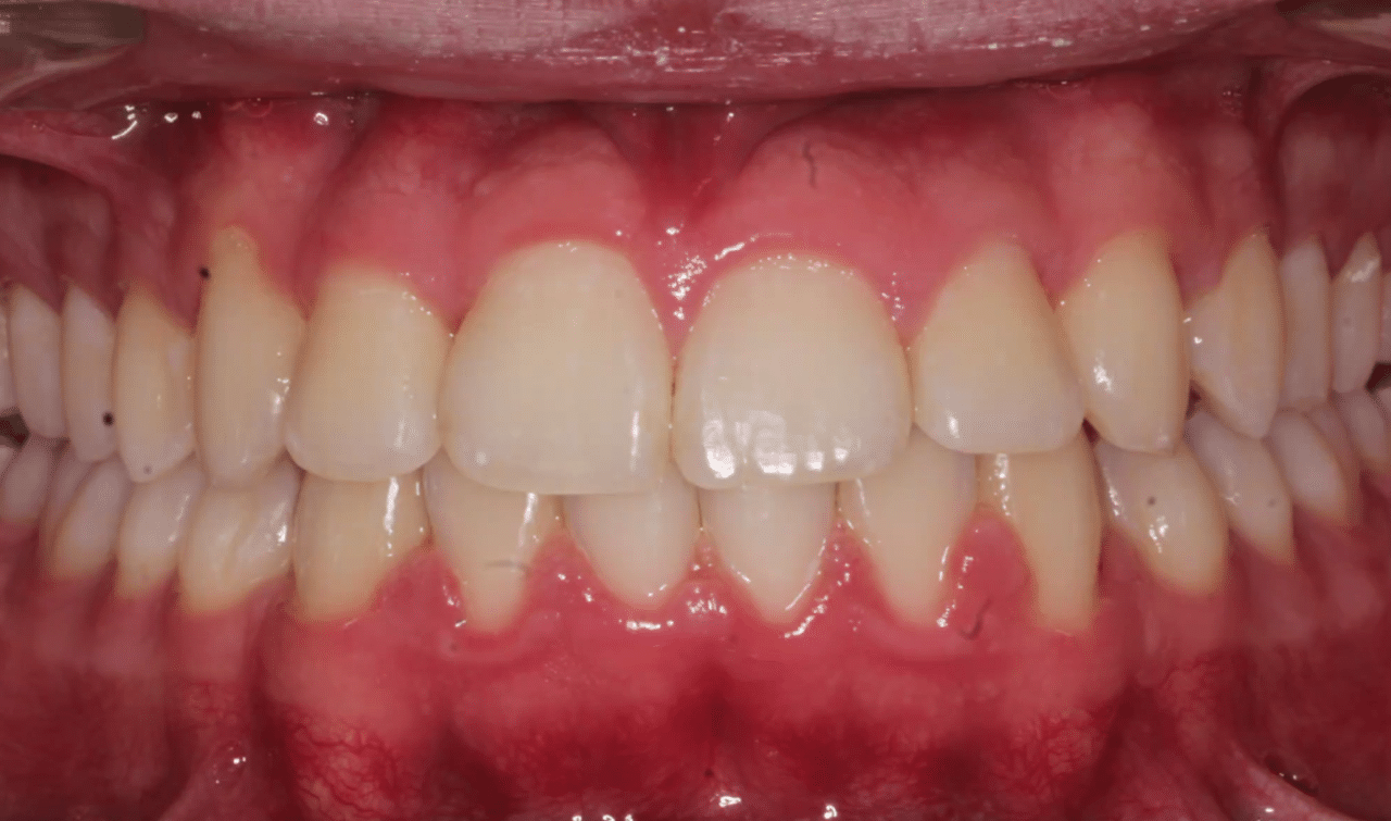 7 after