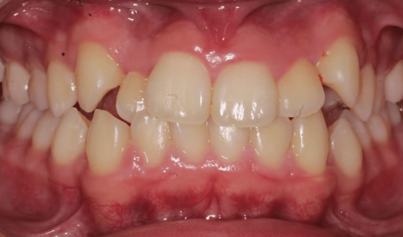 7 before